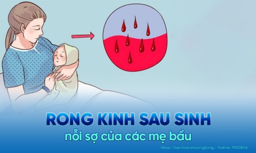 Rong kinh sau sinh tiềm ẩn nguy hiểm gì? Biện pháp điều trị hiệu quả