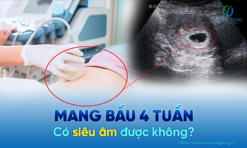 Thai được 4 tuần mẹ có thể đi siêu âm để xem sự phát triển của thai nhi