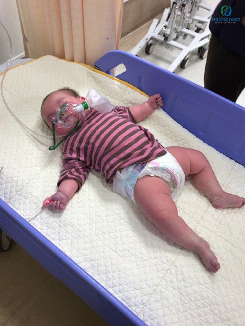Cơ thể em bé bị tím tái vì thiếu oxy