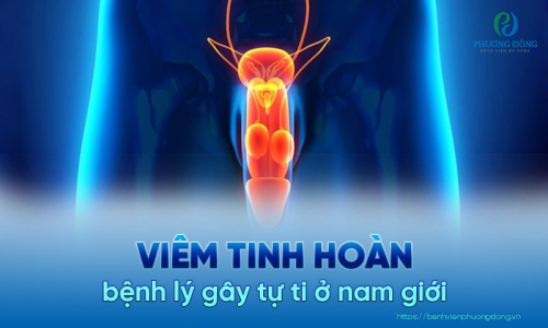 Viêm tinh hoàn và những thông tin chi tiết từ A tới Z