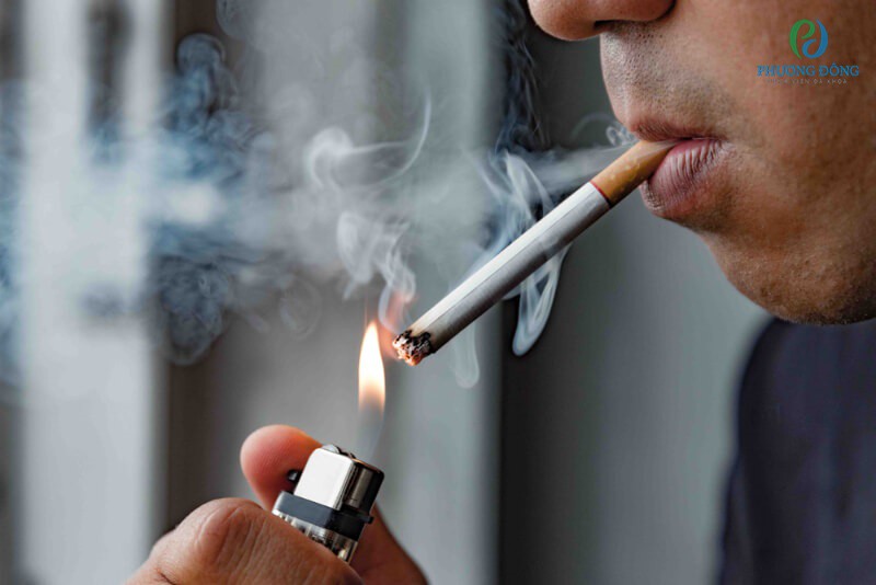 Hút thuốc lá là một trong những nguyên nhân gây ra WBC tăng cao