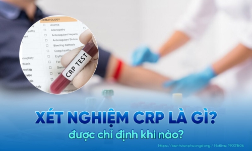 Xét nghiệm CRP - Xét nghiệm kiểm tra viêm hữu hiệu