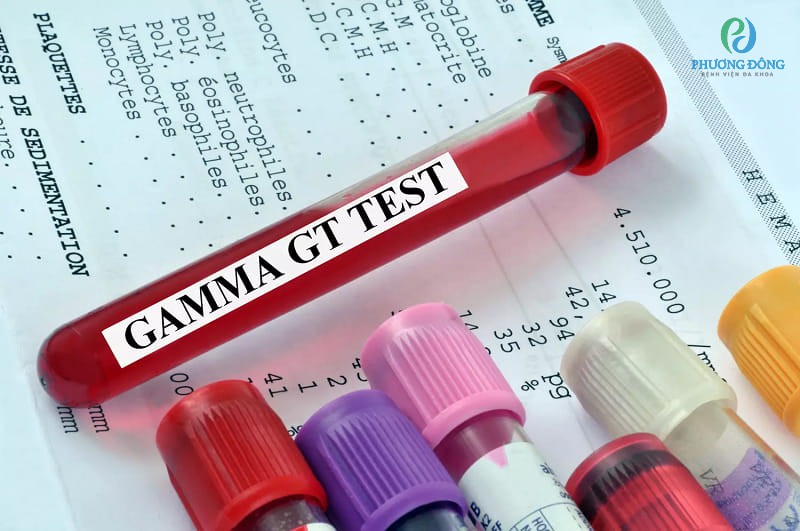 Giải thích xét nghiệm GGT là gì trong kiểm tra sức khỏe gan