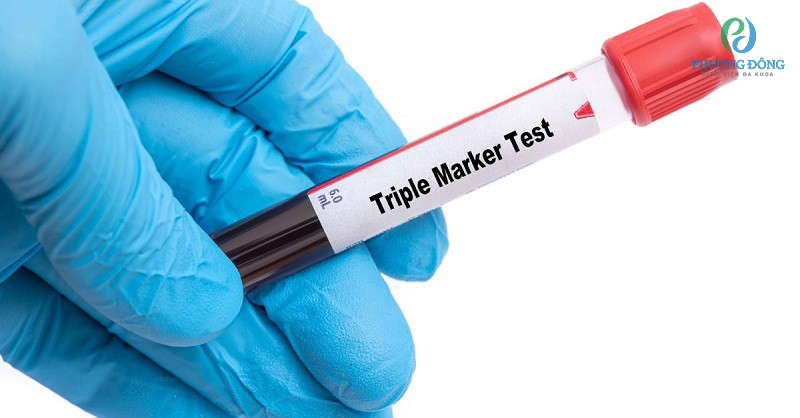Ba mẹ không nên quá lo lắng khi triple test có kết quả dương tính 