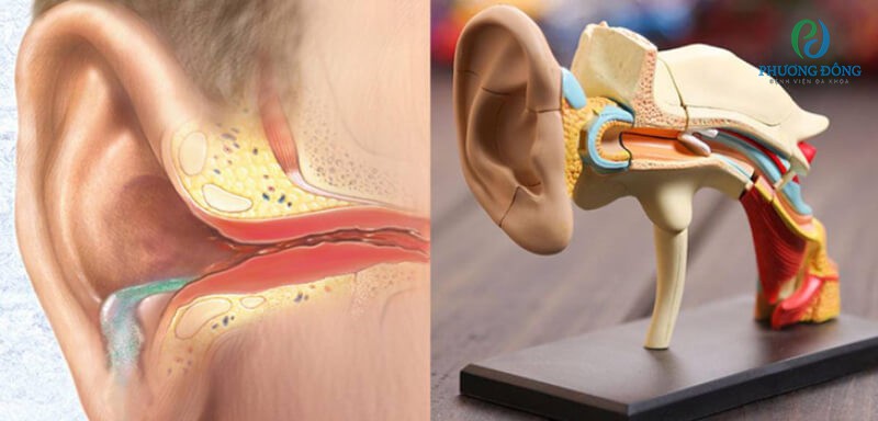 Tình trạng cholesteatoma khiến tai có mùi hôi khó chịu