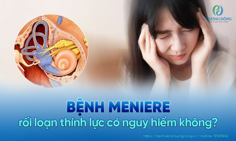 Bệnh Meniere có thể gây ra những tác động nghiêm trọng nào đến cuộc sống hàng ngày của người mắc bệnh?
