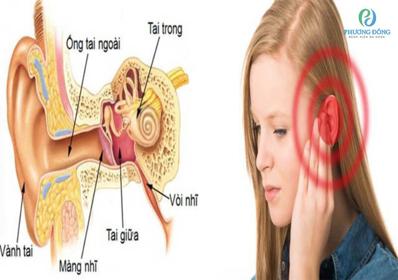 Vòi tai bị rối loạn có thể gây nên tình trạng ù tai thường xuyên