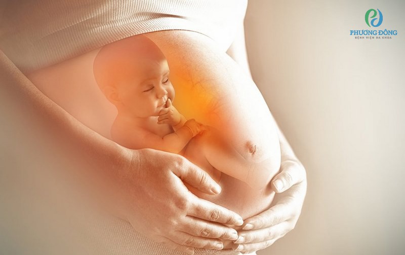 Mang thai có sự gia tăng của các hormone estrogen và progesterone 