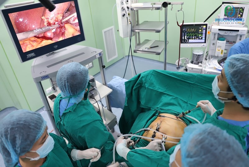 Phẫu thuật nội soi cắt túi mật tại Bệnh viện Đa khoa Phương Đông