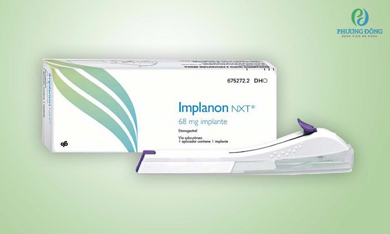 Que cấy tránh thai Implanon NXT (Hà Lan) là loại que phổ biến được nhiều bác sĩ phụ sản tin dùng.