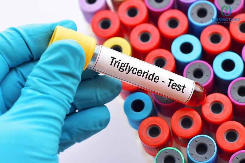 Chỉ số triglyceride trong máu phản ánh tình trạng tim mạch của người làm xét nghiệm