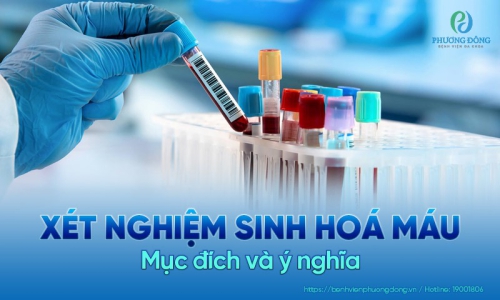 Xét nghiệm sinh hóa máu là gì? Lý giải các chỉ số xét nghiệm quan trọng