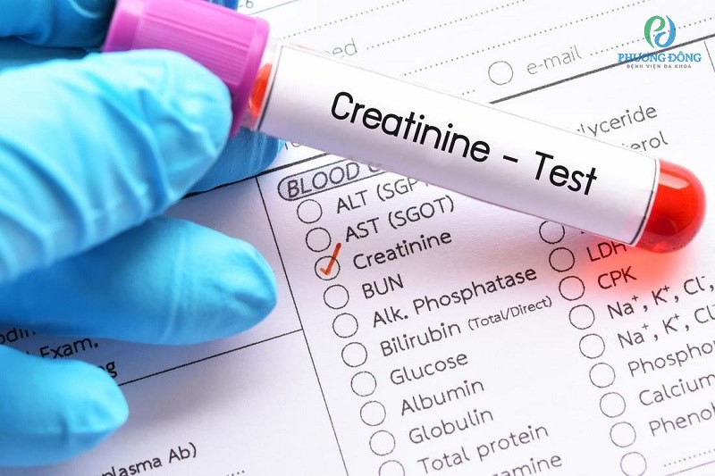 Thử nghiệm creatinin huyết thanh hỗ trợ giúp đánh giá chức năng của thận