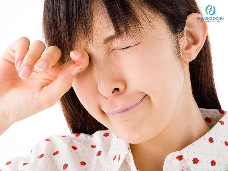 Người bị dị ứng kết mạc mắt thường có biểu hiện ngứa ngáy ở mắt