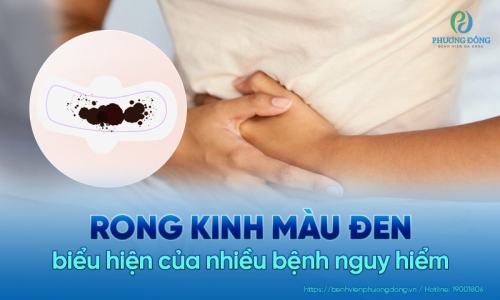 Rong kinh máu đen cảnh báo bệnh lý nào? Cách cải thiện hiện quả