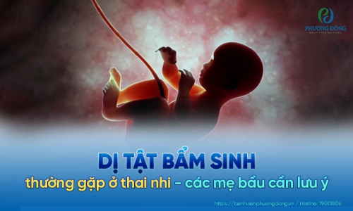 Sàng lọc dị tật thai nhi và những điều cần lưu ý