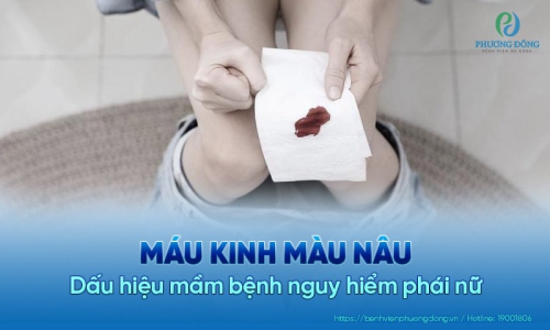Nguyên nhân gây ra máu kinh màu nâu và giải pháp xử lý an toàn
