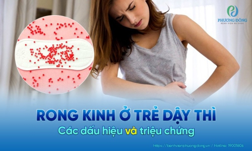 Rong kinh ở tuổi dậy thì - một nỗi phiền toái của các bé gái