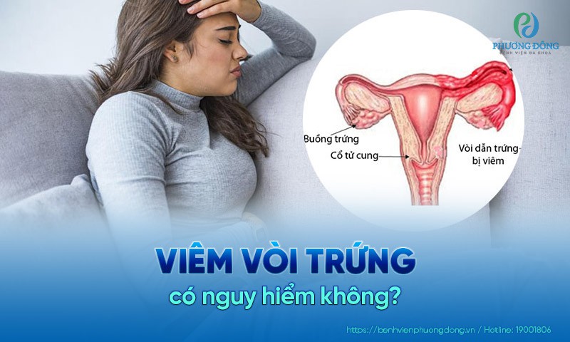 Viêm vòi trứng là gì?
