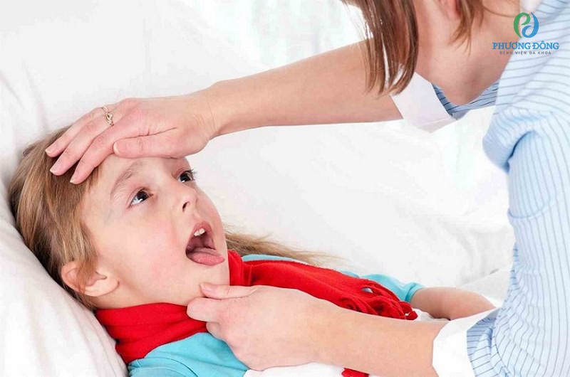 Viêm loét miệng họng sốt cao là tình trạng phổ biến ở trẻ nhỏ
