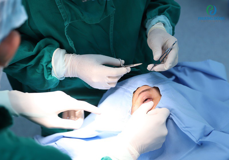 Phẫu thuật đục thủy tinh thể tại Bệnh viện đa khoa Phương Đông