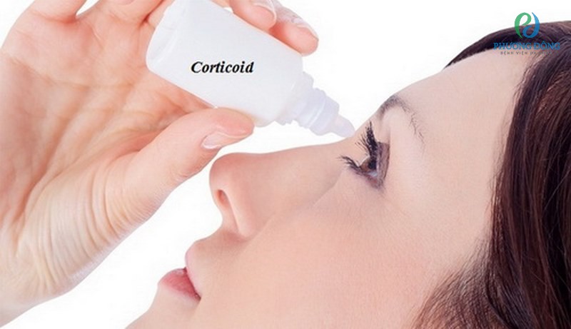 Thuốc nhỏ mắt chứa chất kháng viêm Corticosteroid được sử dụng nhiều