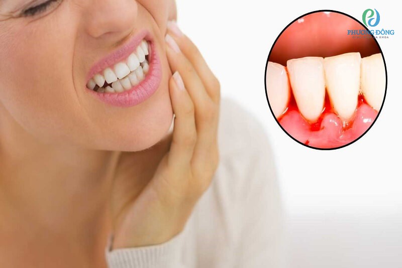 Vệ sinh răng miệng không đúng cách là nguyên nhân hàng đầu gây bệnh