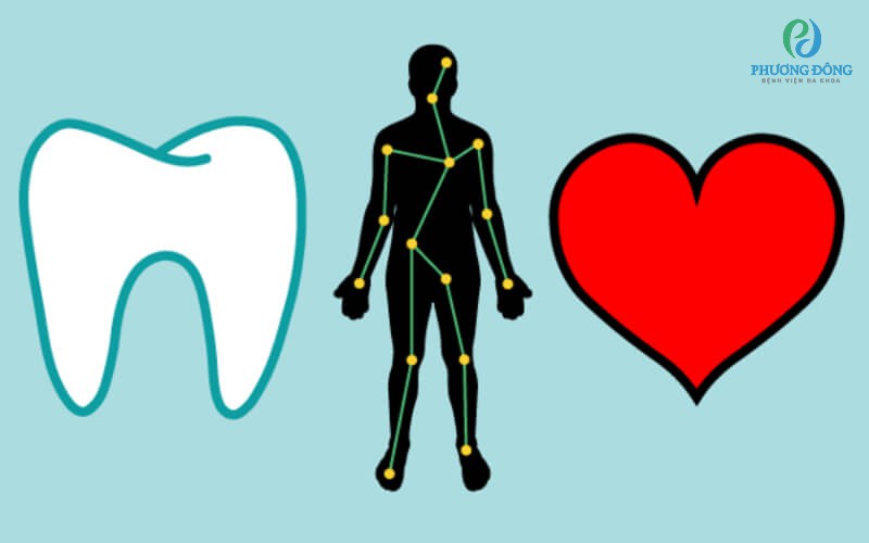 Bệnh về răng miệng có thể gây nên biến chứng tim mạch