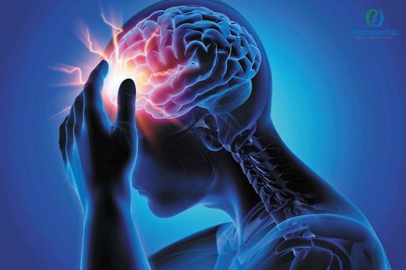 Gặp phải vấn đề hệ thần kinh cũng gây ra chứng đau nửa đầu ở bên phải