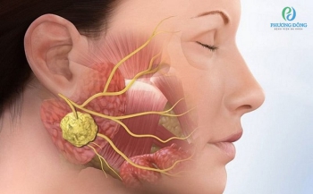 Đau quai hàm - Triệu chứng và phương pháp điều trị hiệu quả