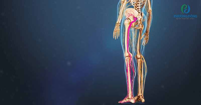 Cảm giác đau ở cột sống thắt lưng hoặc ở một bên chân là một dấu hiệu khá phổ biến. 