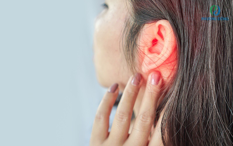 Triệu chứng của viêm sụn vành tai là gì? 
