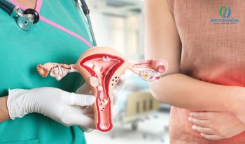 Cổ tử cung hẹp là gì, gây ảnh hưởng đến sinh sản không và cách chữa
