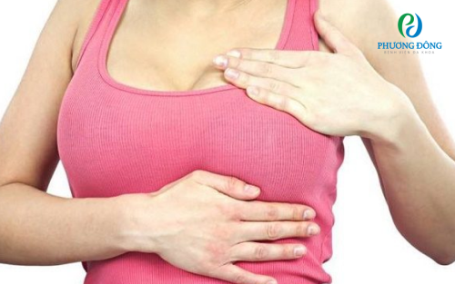 Khối u ở vú là gì? Nguyên nhân, dấu hiệu và cách phòng ngừa