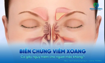 Biến chứng viêm xoang: Có gây nguy hiểm cho người mắc không?