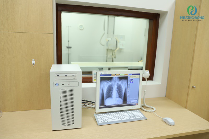 thiết bị chụp X quang kỹ thuật số tiên tiến