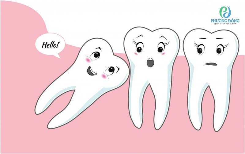 Số lượng tối đa của răng khôn mà một người trưởng thành có thể có là 4 chiếc