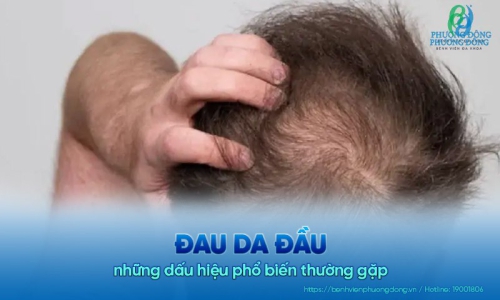 Đau da đầu và những dấu hiệu phổ biến thường gặp