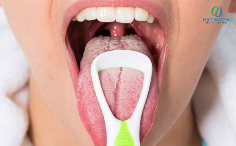 Chú ý vệ sinh răng miệng đúng cách