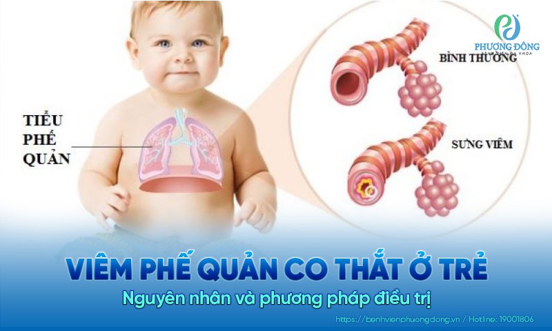 4. Phương pháp chẩn đoán