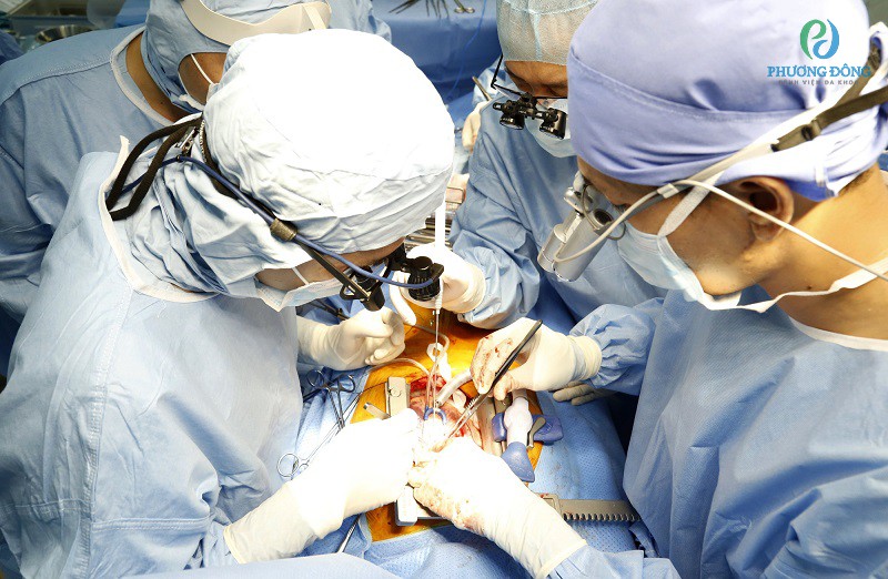 Phẫu thuật được áp dụng khi bệnh tái phát thường xuyên
