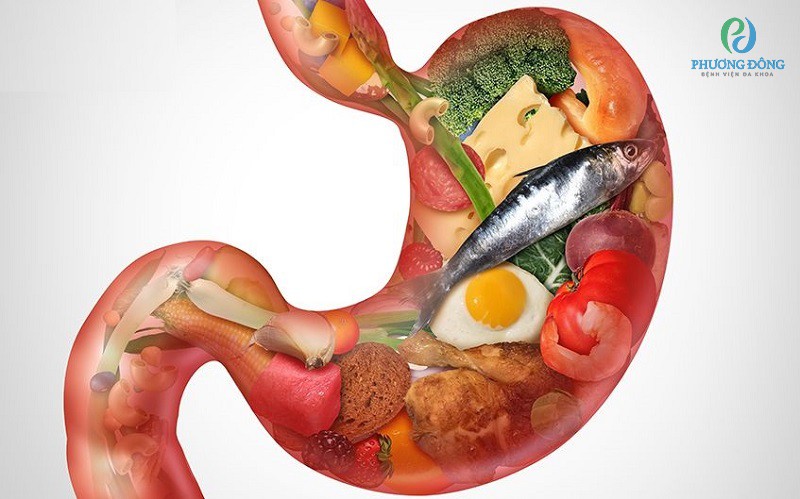 Ăn uống, sinh hoạt không lành mạnh gây nên viêm hang vị dạ dày