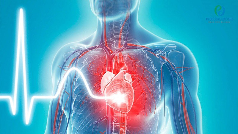 Viêm màng ngoài tim co thắt là một trong những biến chứng của bệnh