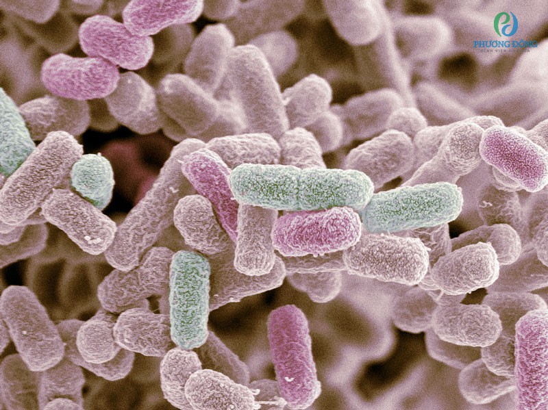 Vi khuẩn E.coli là nguyên nhân gây bệnh ở trẻ sơ sinh