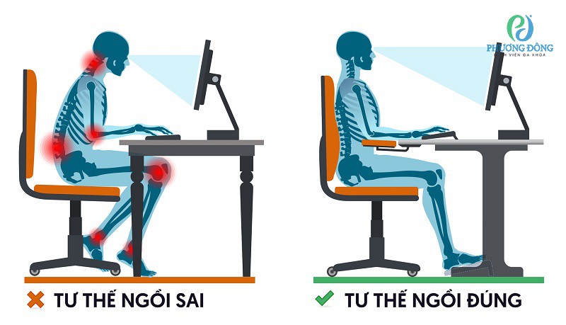 Sai tư thế ngồi khi làm việc trước máy tính có thể gây ra tình trạng đau mỏi cổ vai gáy