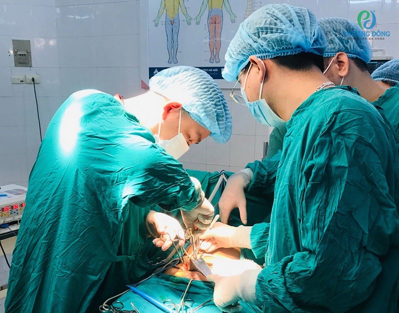 Các bác sĩ đang phẫu thuật loại bỏ nang nước thừng tinh ở trẻ
