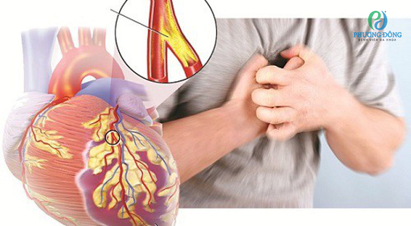 Hội chứng Turner làm tăng nguy cơ cao các bệnh về tim mạch