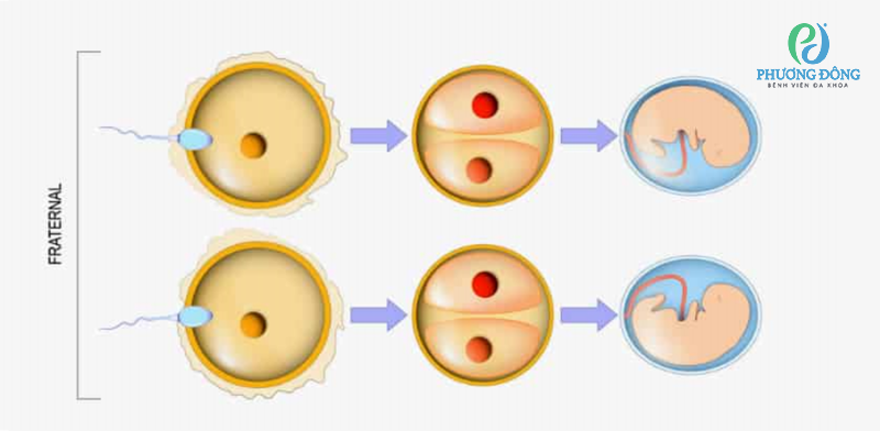 Cơ chế sinh đôi khác trứng xảy ra như thế nào?