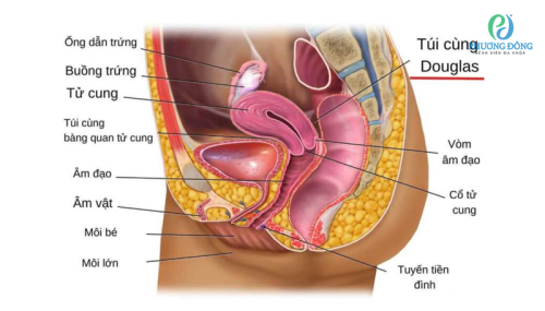 Túi cùng Douglas là gì? Thông tin về chọc dò túi cùng Douglas