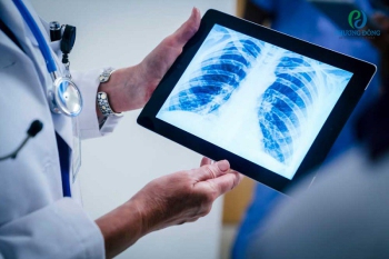 Chụp X-quang phổi phát hiện bệnh gì? Có hại cho sức khoẻ không?